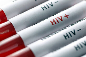 ایدز در زمره بیماری‌های قابل کنترل است