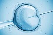 شیوع بیماری‌ها و ناهنجاری‌های ژنتیکی در نوزادان IVF بیش از سایر نوزادان نیست