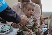 یونیسف: هر ۱۰ دقیقه یک کودک یمنی جان خود را از دست می‌دهد