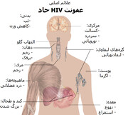  ۳۹۴ مبتلا در گیلان، ایدز را بشناسیم تا دچار نشویم