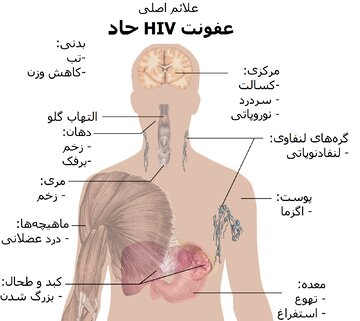  ۳۹۴ مبتلا در گیلان، ایدز را بشناسیم تا دچار نشویم