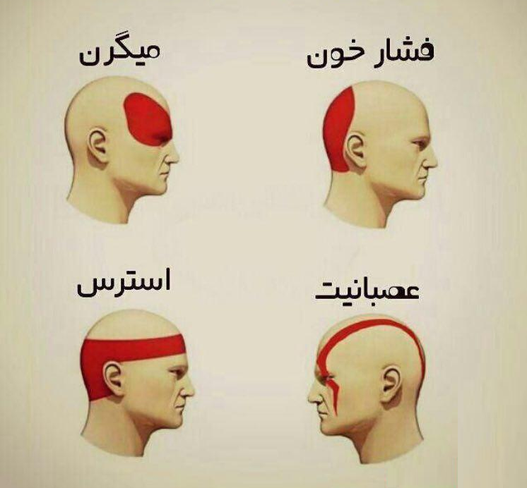 آگاهی عمومی از سردرد مانع بروز ناتوانی است