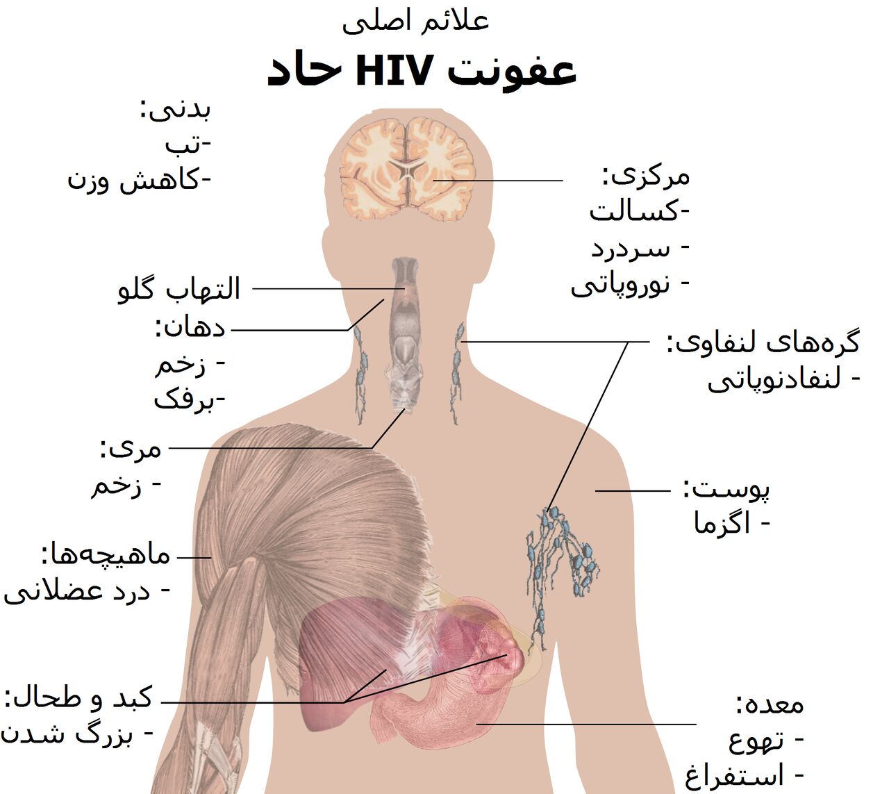  ۳۹۴ مبتلا در گیلان، ایدز را بشناسیم تا دچار نشویم