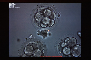 جنین هایی چند روزه در دستگاه امبریوسکوپ.